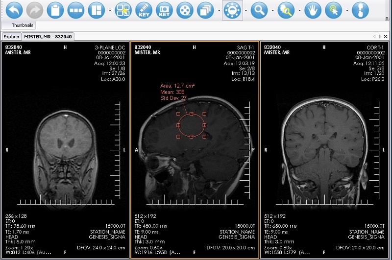 XRayline Workstation 64 bit